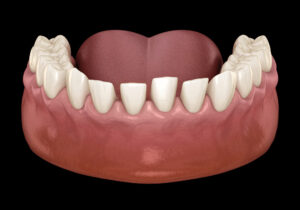 The image shows a close-up view of the lower jaw with permanent teeth growing behind a row of baby teeth, depicted in a realistic anatomical perspective.