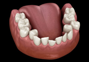 The image shows a close-up view of the lower jaw with permanent teeth growing behind a row of baby teeth, depicted in a realistic anatomical perspective.