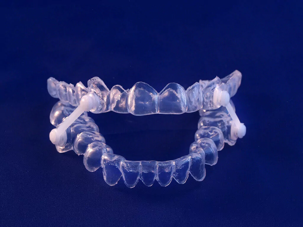 mandibular advancement appliance