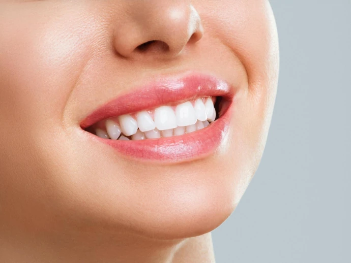 Smile Makeover in West Allis, WI at Third Coast Family Dental.